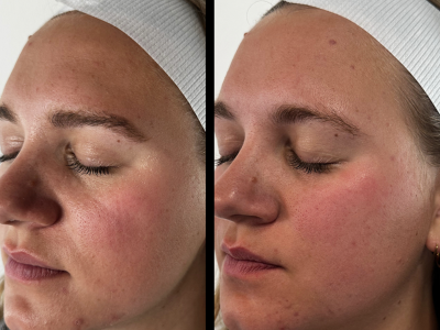 Screenshot 2025-03-04 at 5.34.05 PM